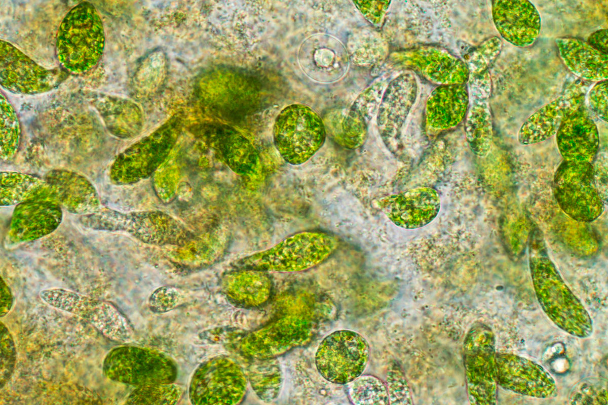 Phytoplankton in Pond Water