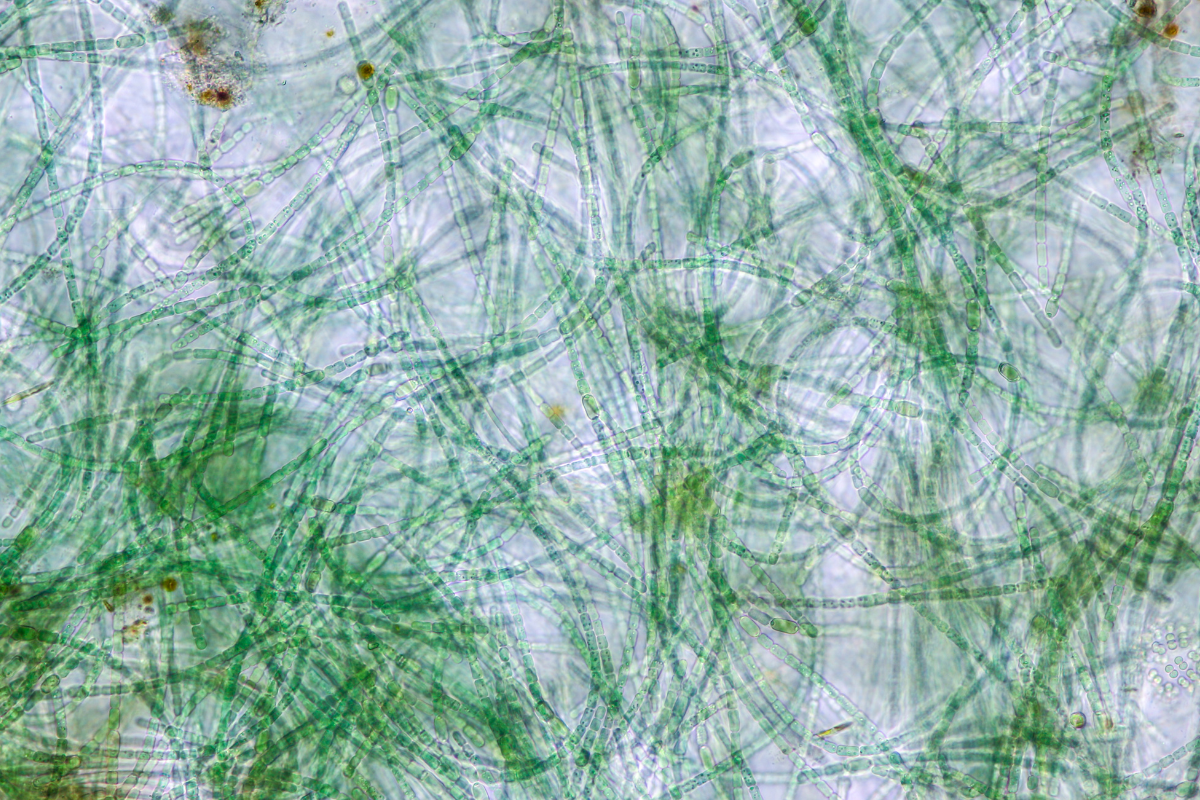 Microscopic View of Pond Algae