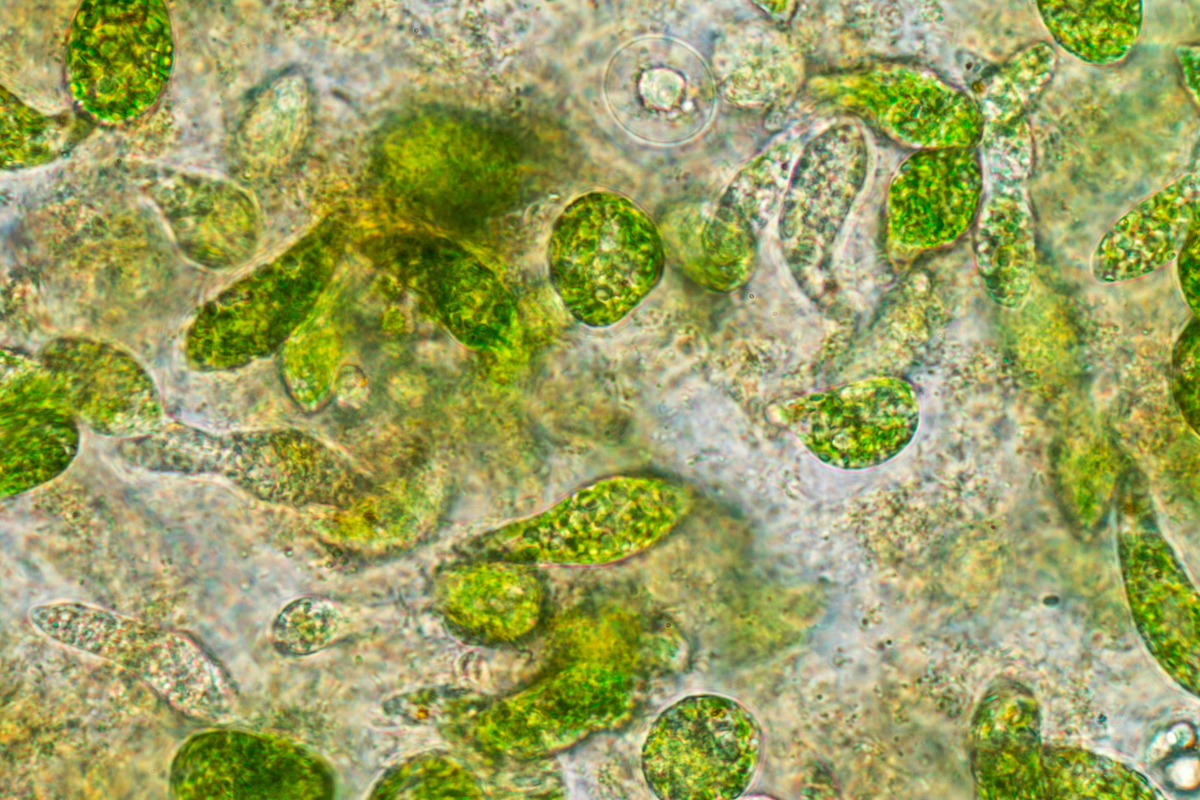 Phytoplankton in a Pond